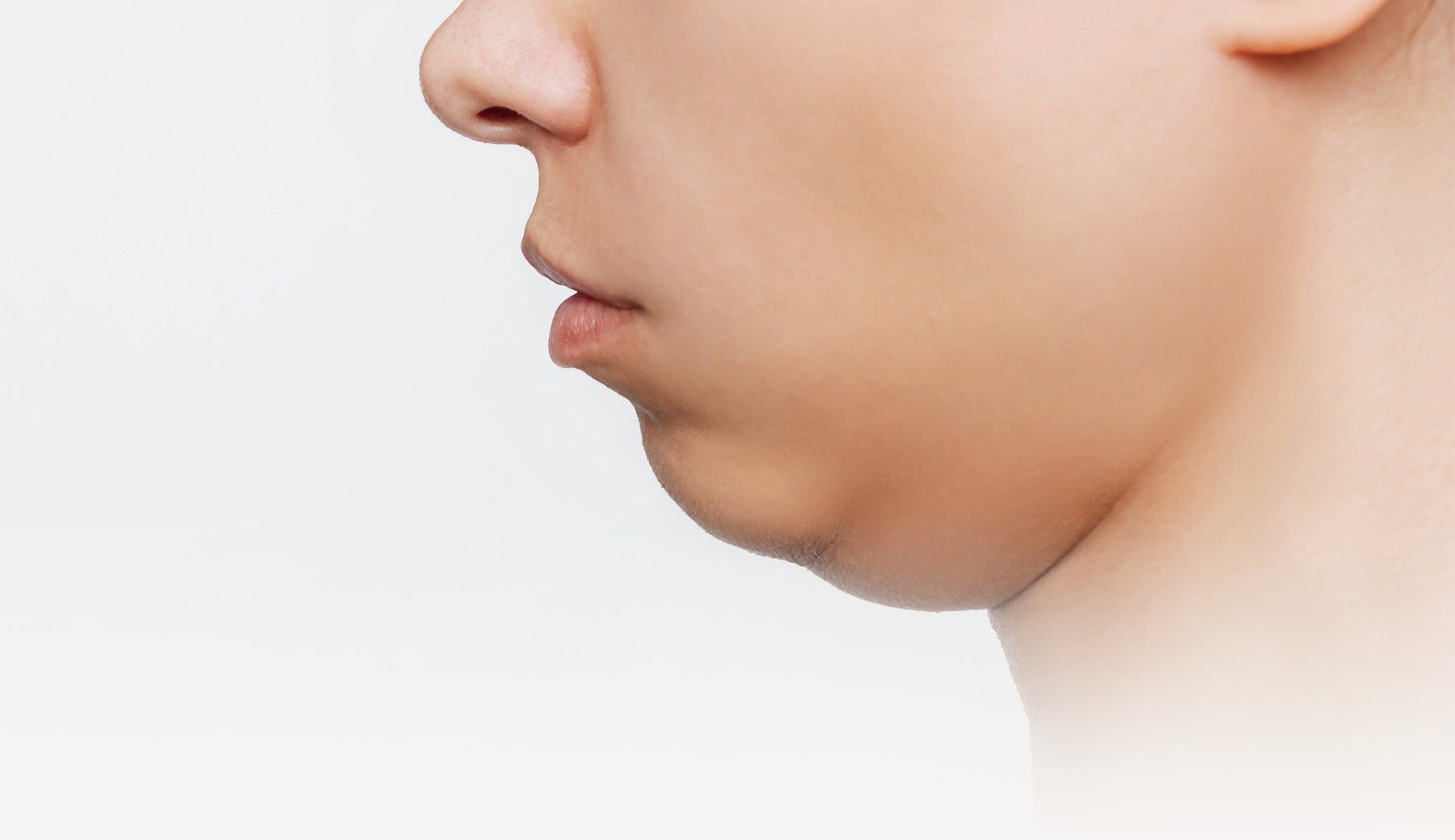 Cheek Augmentation Whitby