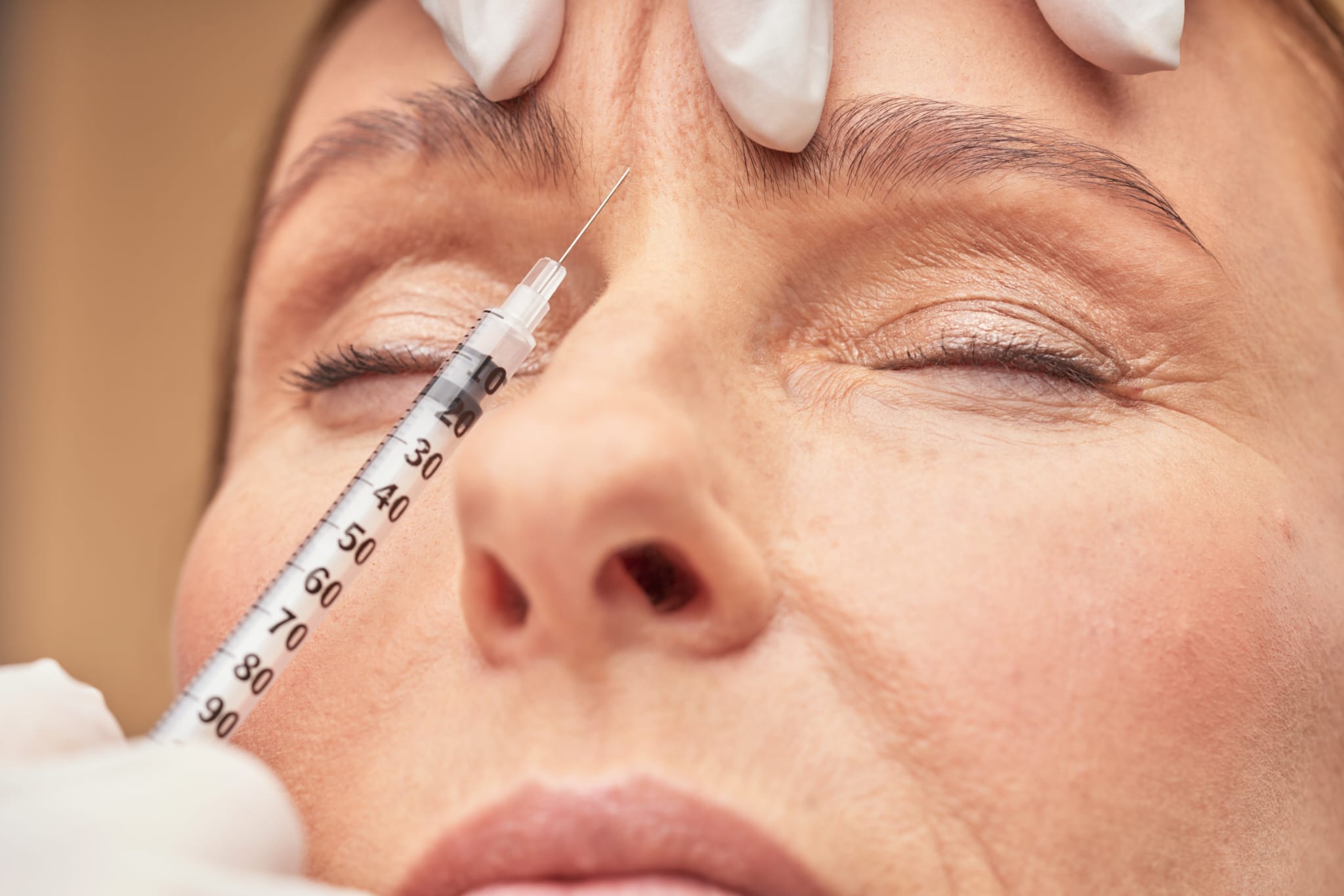 frown line treatment