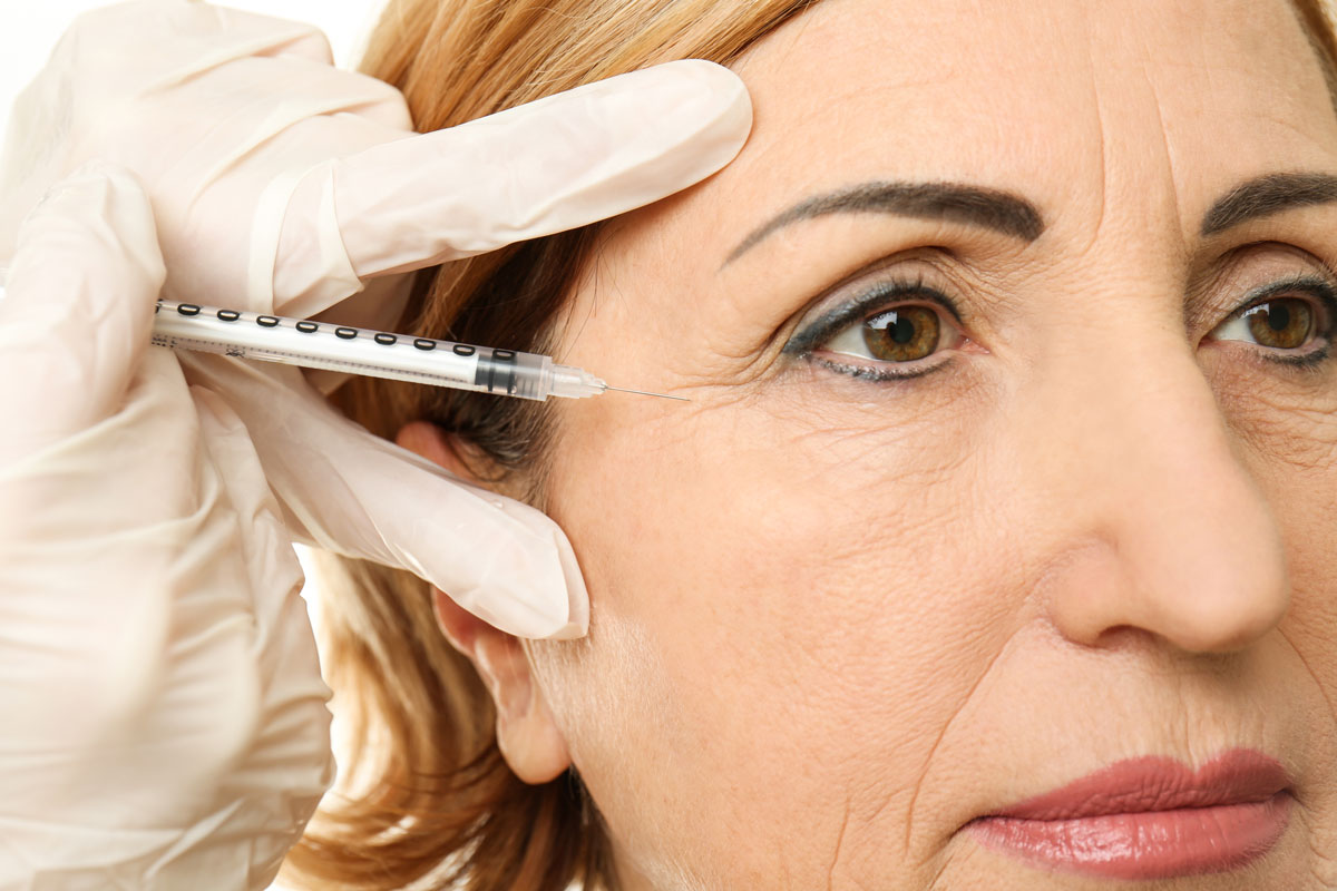 Crows Feet Botox 