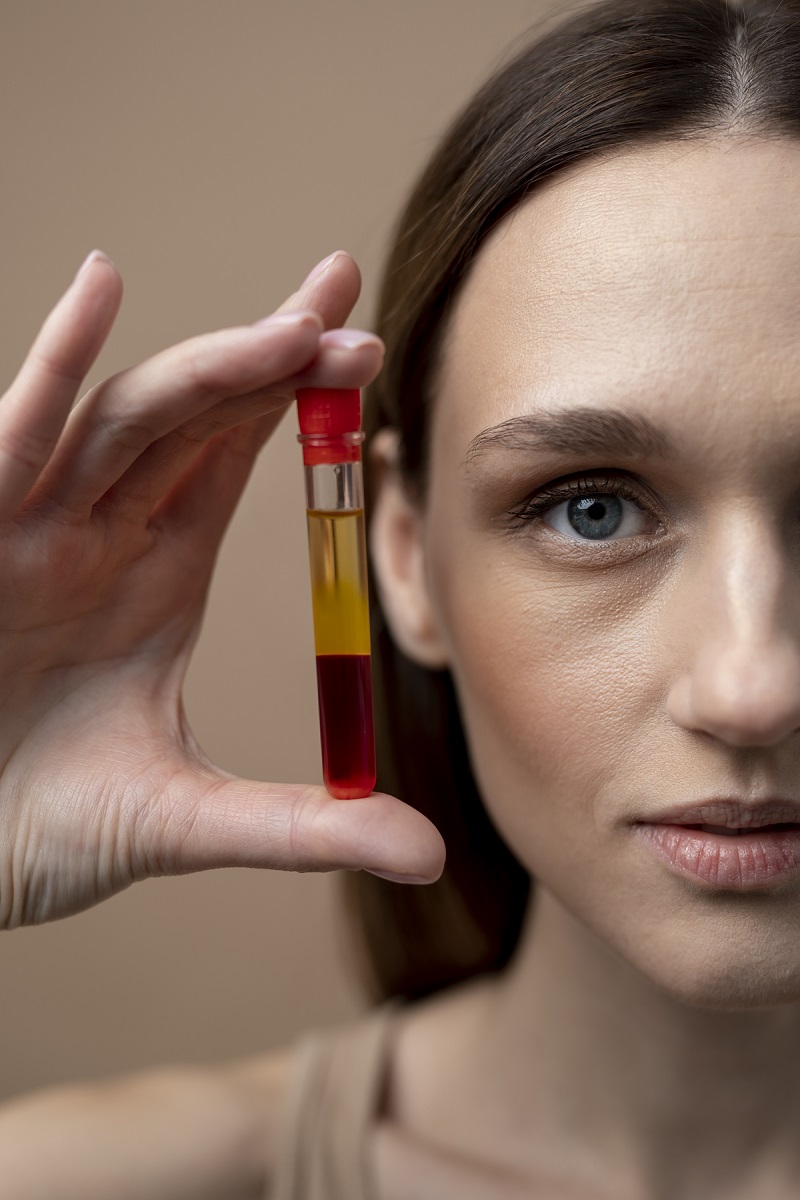 The Benefits of PRP for Skin Rejuvenation