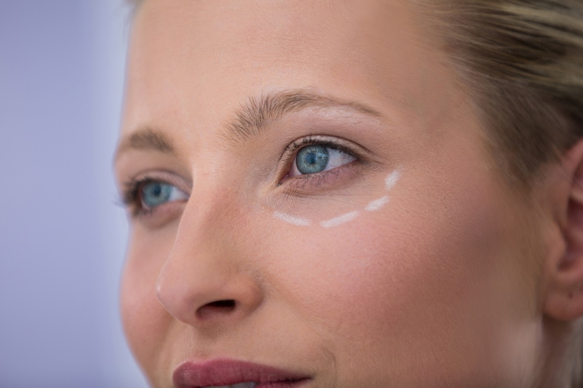 Can Under-Eye Fillers Help with Fine Lines and Wrinkles?