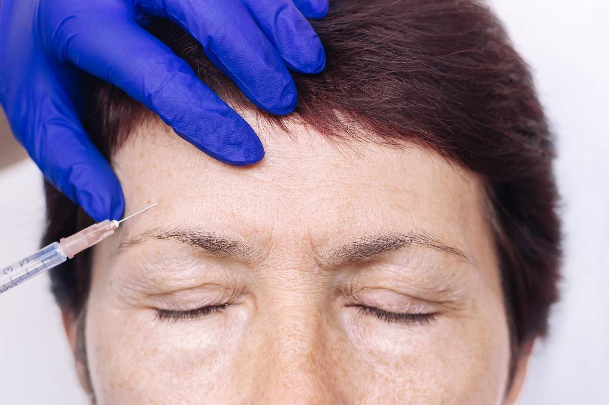 Effective Treatments for Forehead Lines