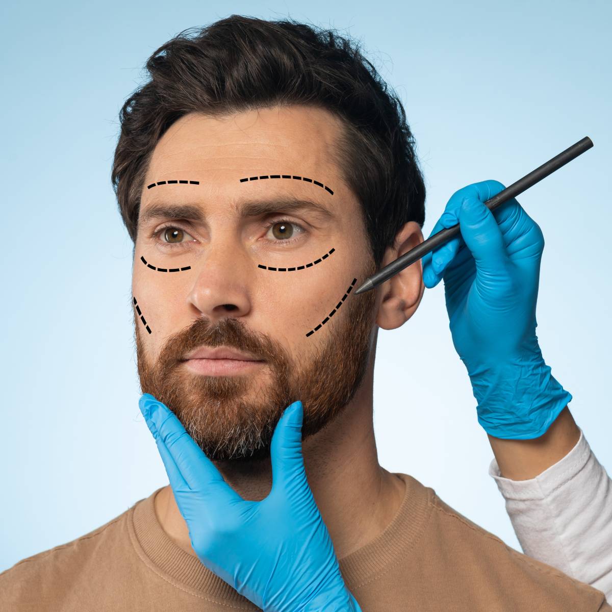 Dermal Fillers