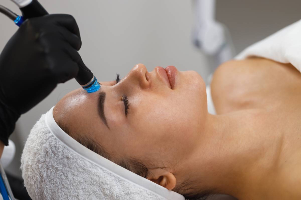 How Many RF Microneedling Sessions Do You Really Need?