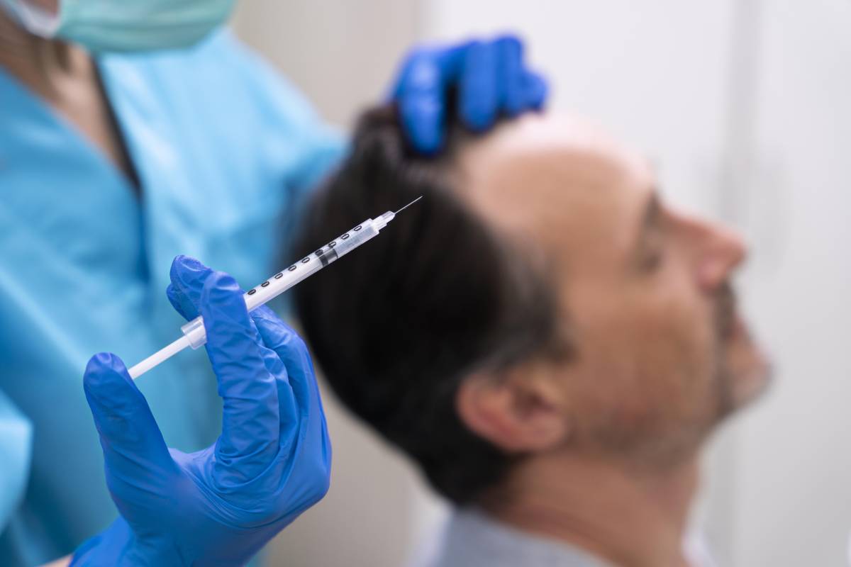 Rediscover Your Hair’s Beauty with PRP Therapy
