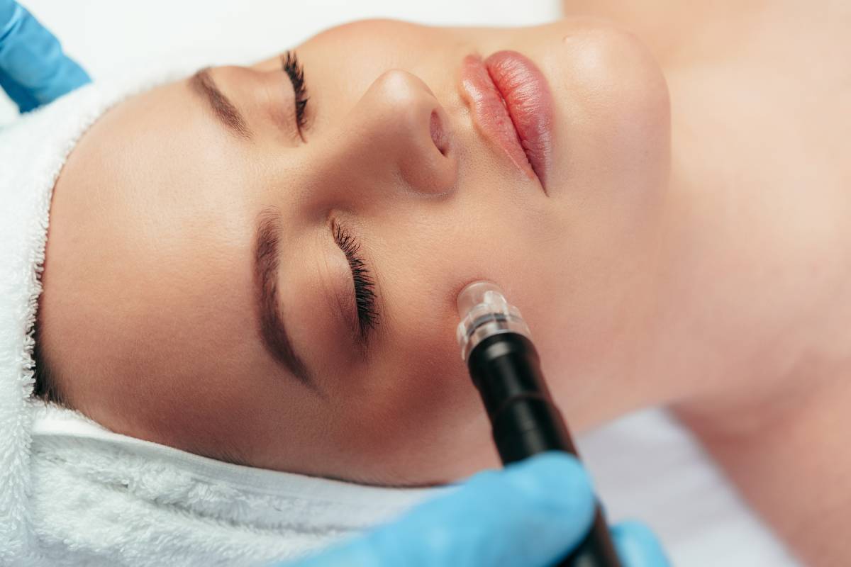 If I Microneedle My Face, Will My Pores Disappear Forever?