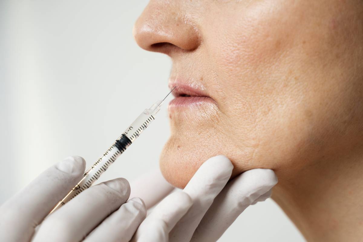 Smoker’s Lines Botox Cost