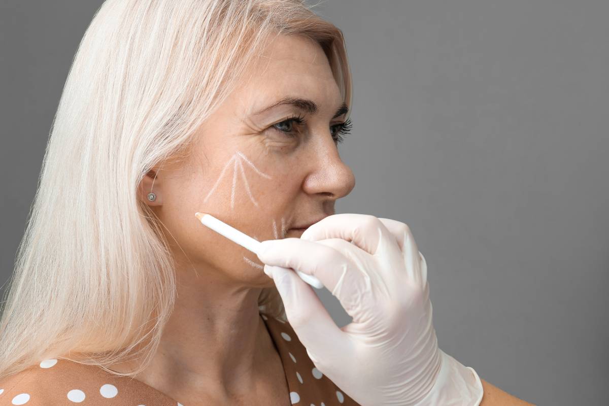 What Happens During the Filler Facelift Procedure