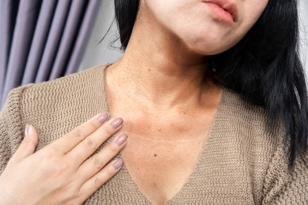 Radiofrequency (RF) Skin Tightening