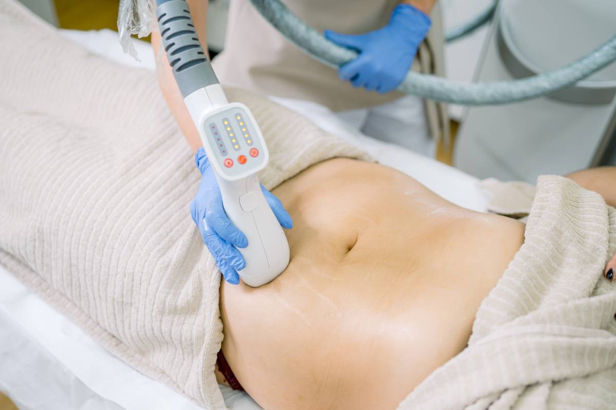 Can HIFU Tighten Loose Skin on the Abdomen?