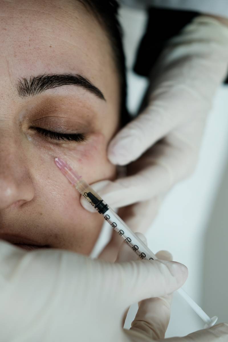 How Long Do Under-Eye Fillers Last