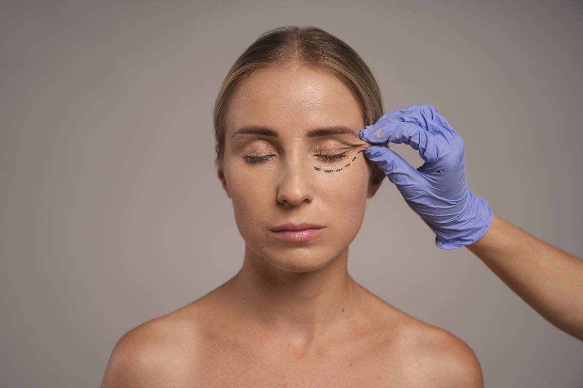 10 important things you should know before getting under-eye filler injections