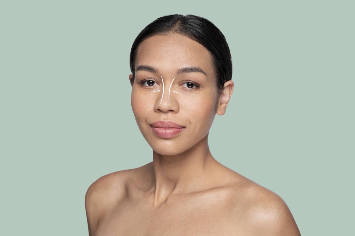 The Cost of Nose Fillers in Canada: What You Should Expect to Pay