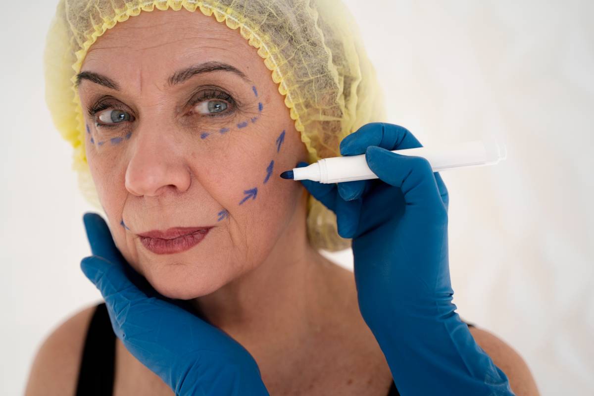 Thread Lifts vs. HIFU: Which Non-Surgical Facelift is Right for You?