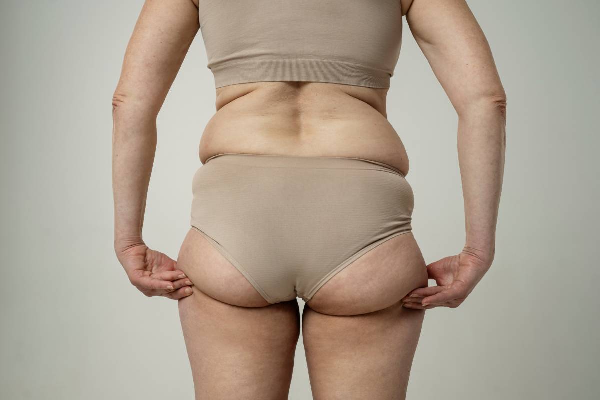 Are Fat Dissolving Injections Right for You?