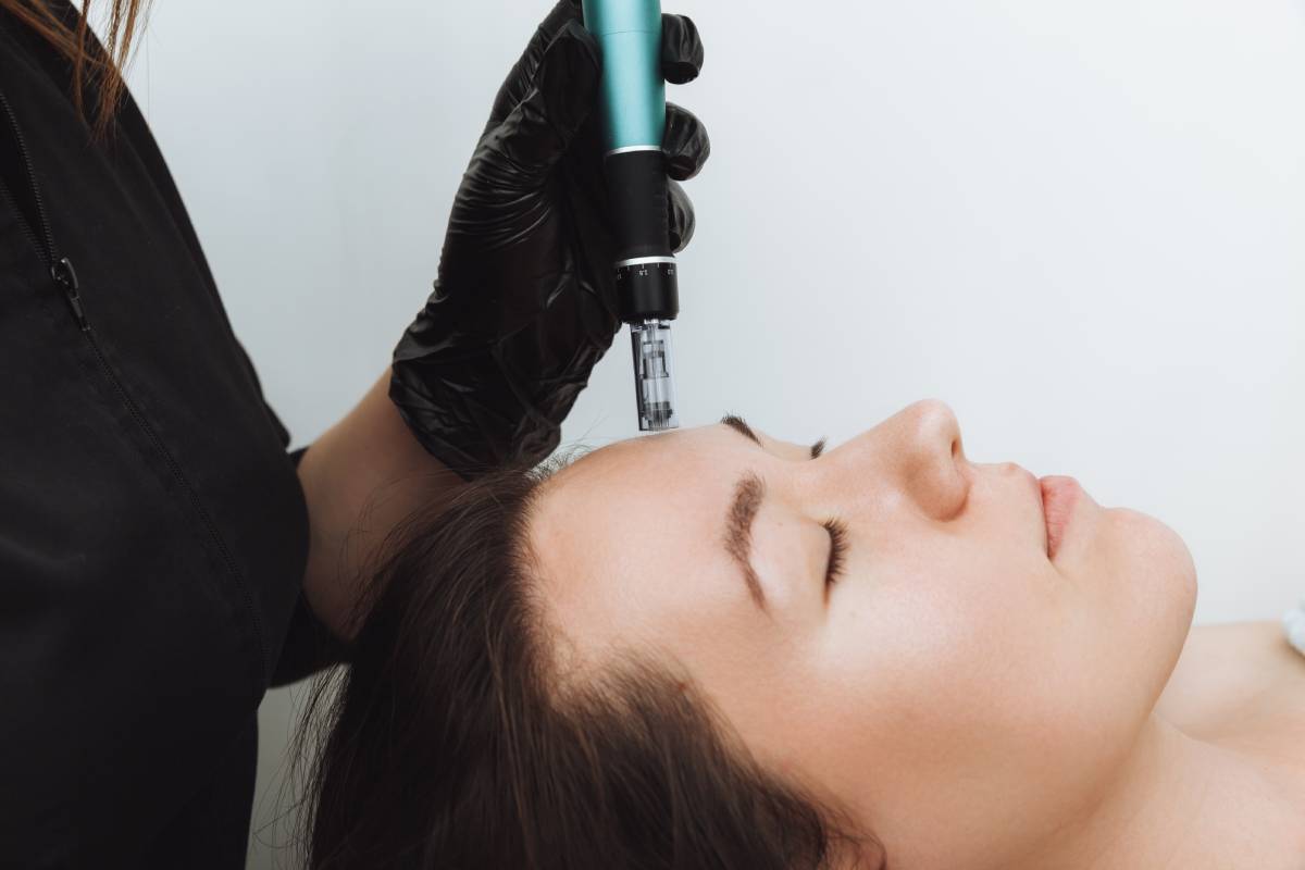 What Does a Microneedling Session Actually Feel Like?