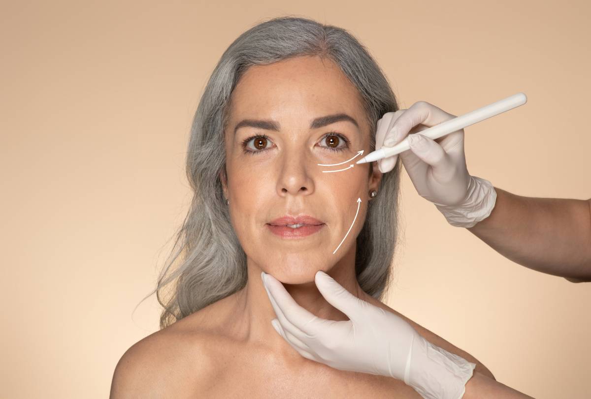 The Best Non-Surgical Facelift Methods for Women Over 40
