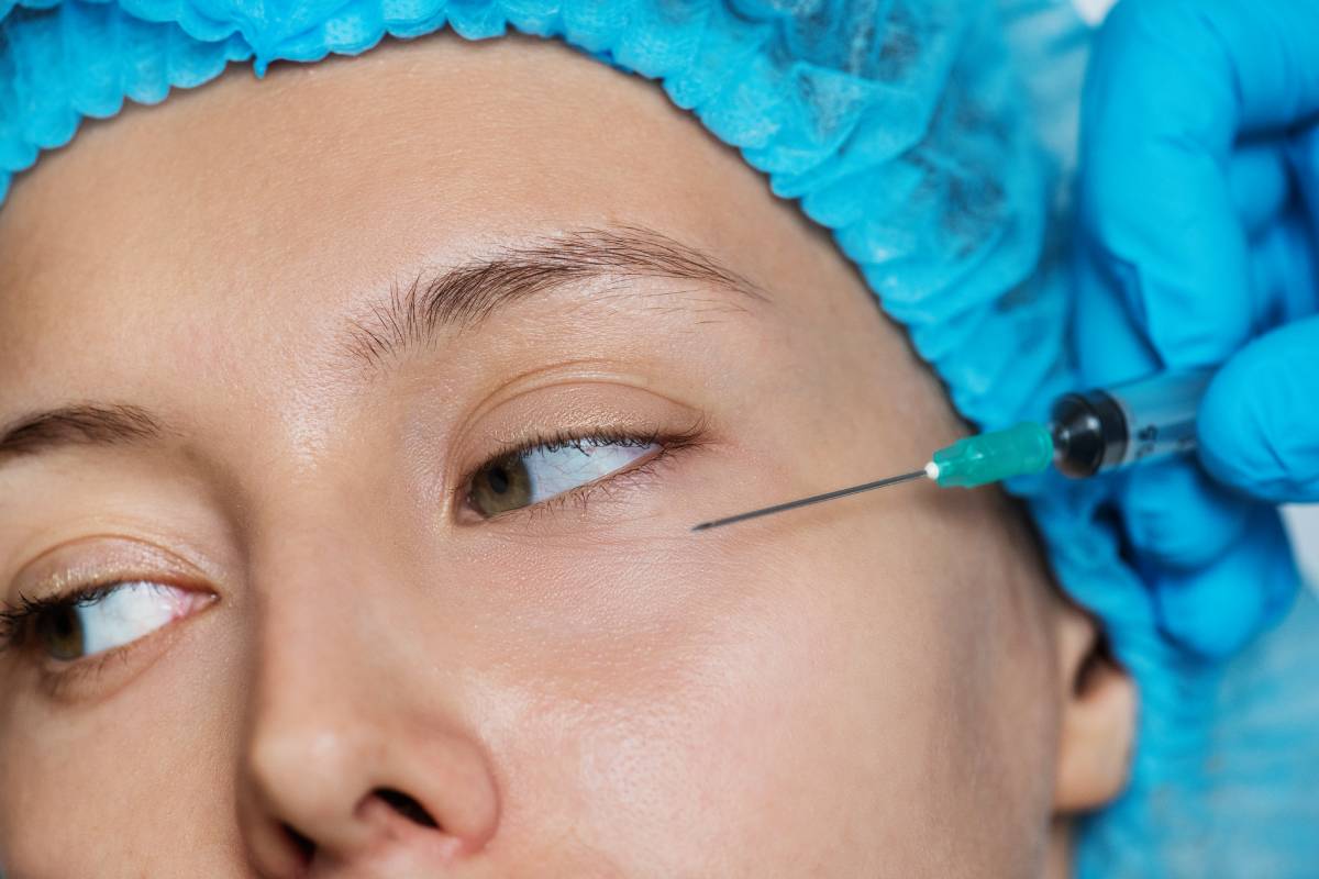 Dermal Fillers for Under-Eye Hollowness