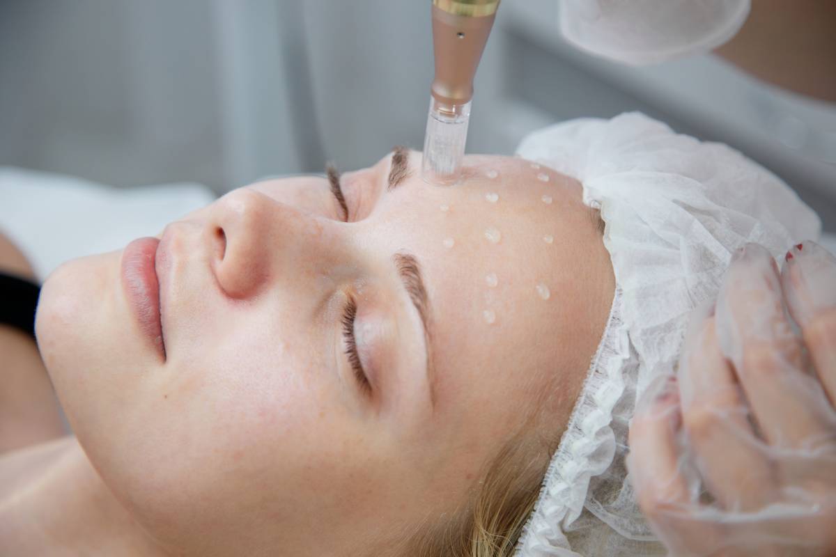 Is Mesotherapy the Solution for Your Dry Skin?