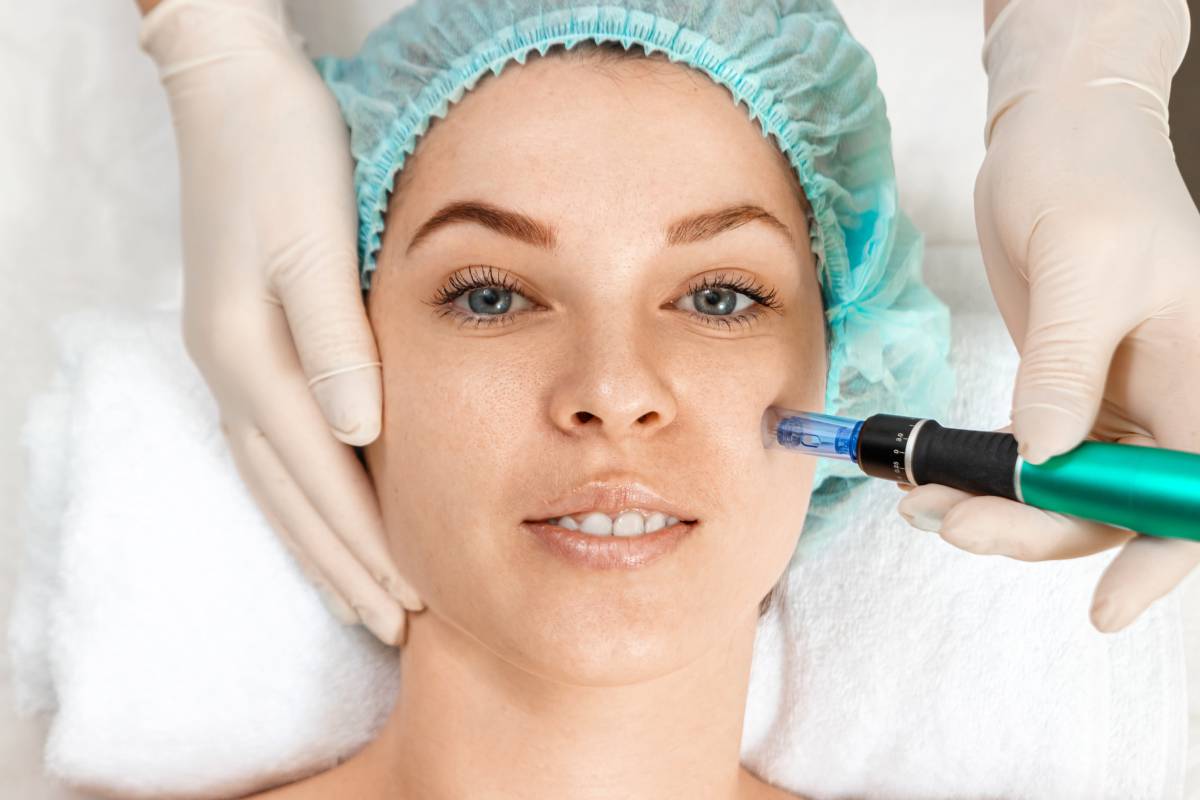 Who Is a Good Candidate for Mesotherapy?