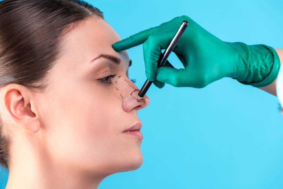 Non-Surgical Rhinoplasty: Reshaping the Nose with Fillers