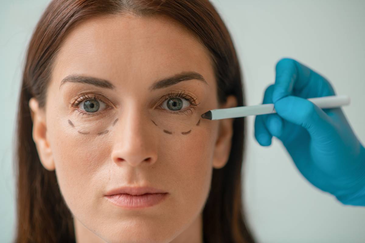 The Best Fillers for Under-Eye Hollowing: What Works and What Doesn’t