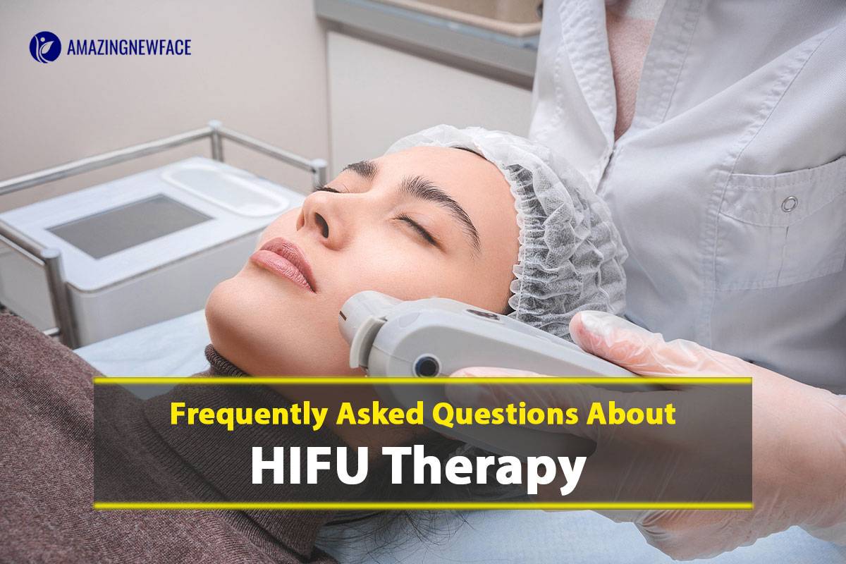 Frequently Asked Questions About HIFU Therapy