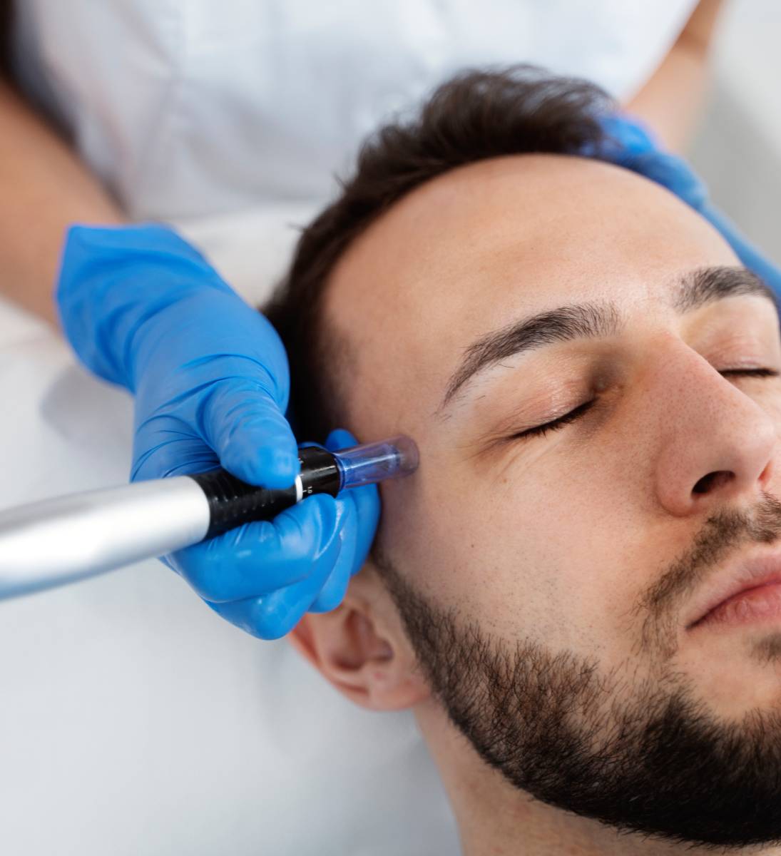 After Microneedling Care