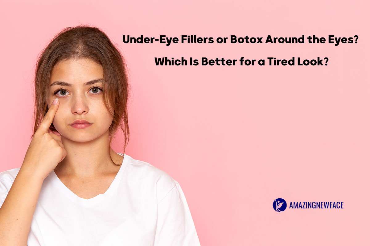 Under-Eye Fillers or Botox Around the Eyes? Which Is Better for a Tired Look?