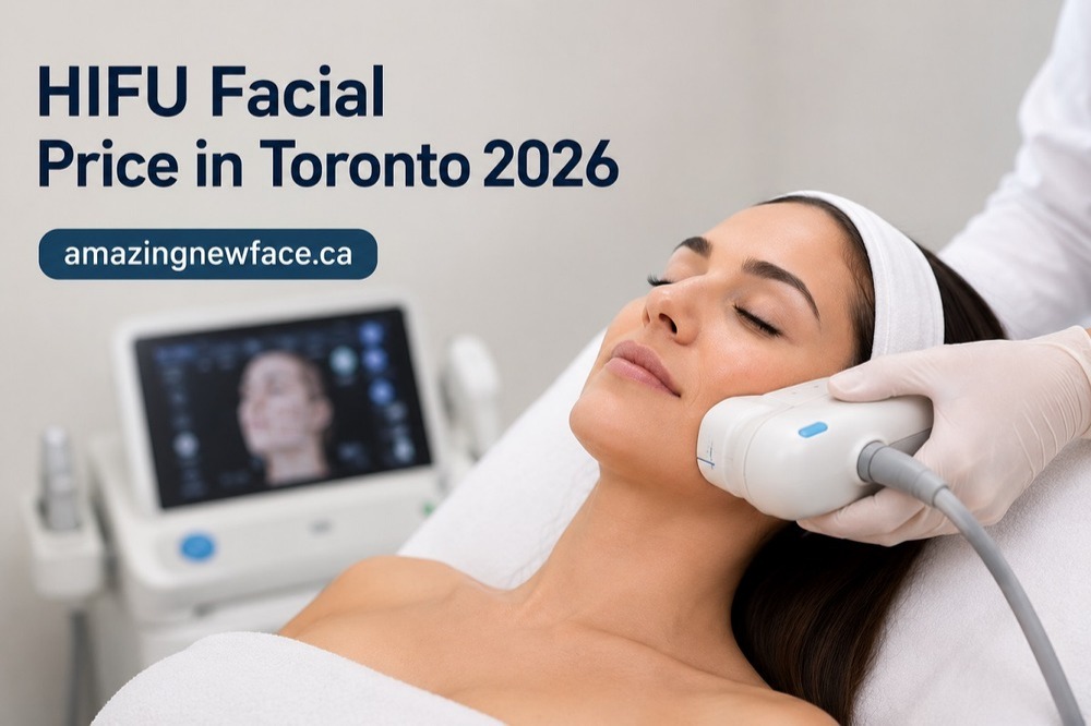 HIFU Facial Price in Toronto 2026 + What Actually Affects the Cost?
