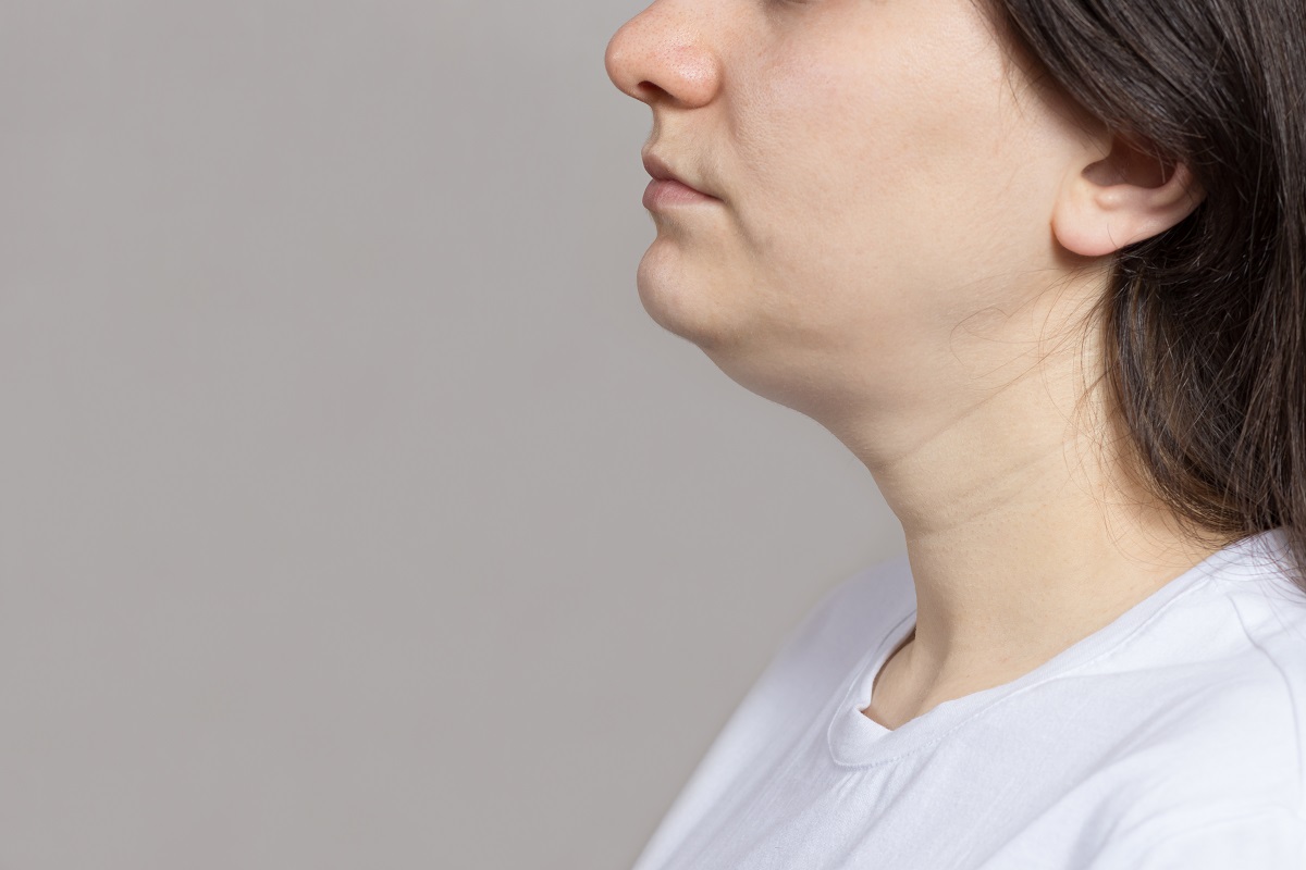 Is HIFU Safe for the Chin and Neck?