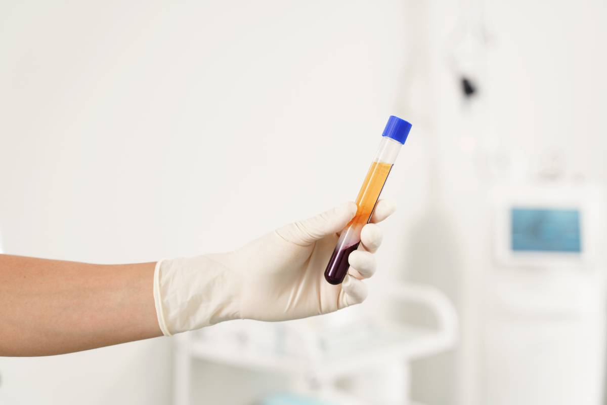 What Is PRP? What Is PRP?