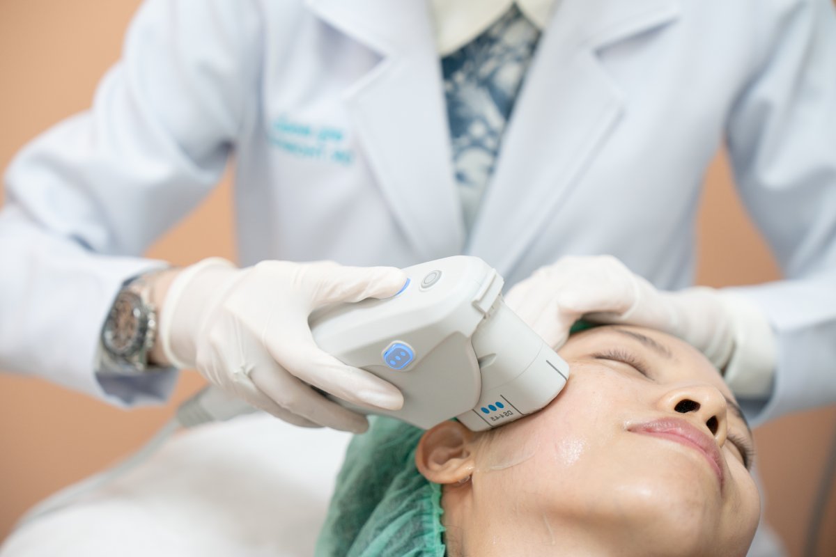 Ultherapy for facelift