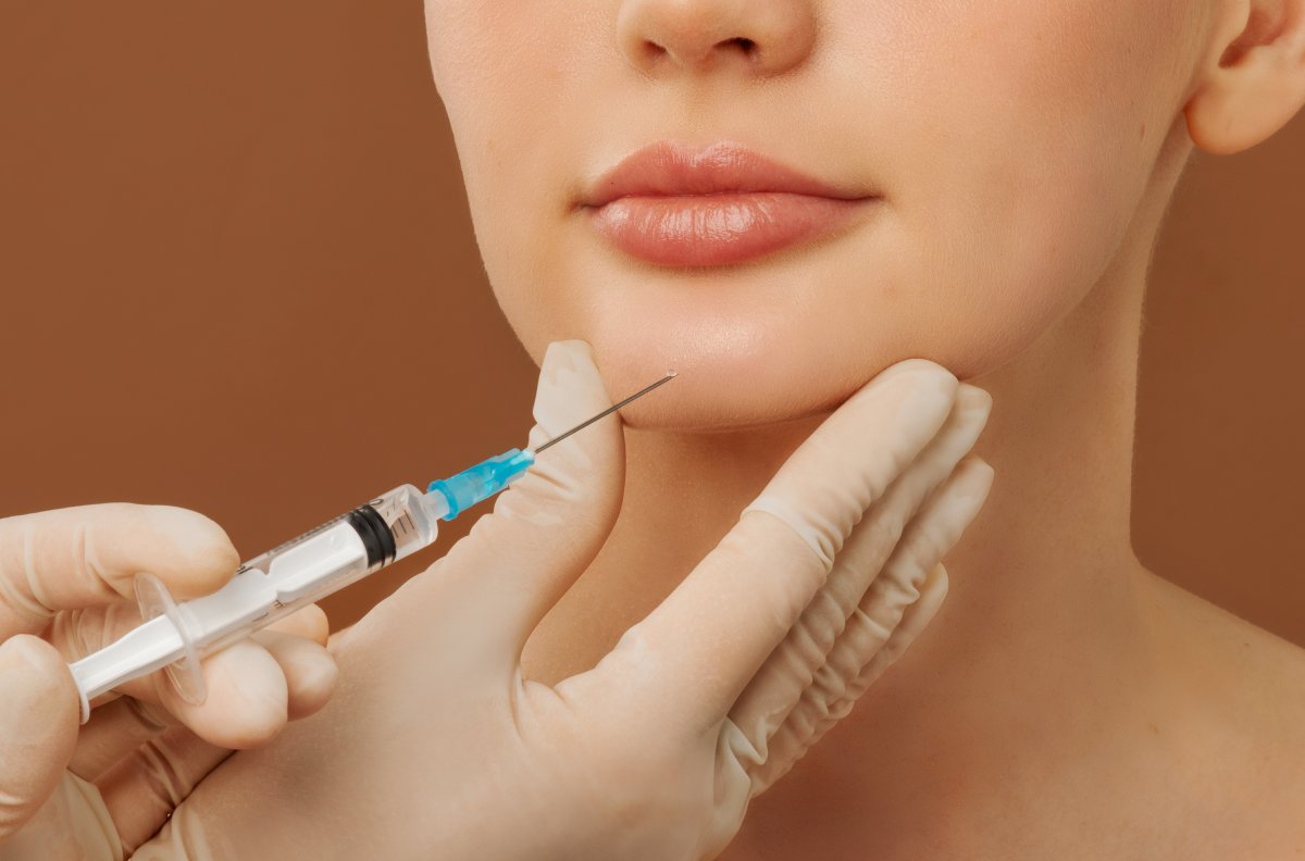 Side-Profile Assessment in Thornhill: When Chin Filler May or May Not Fit the Goal