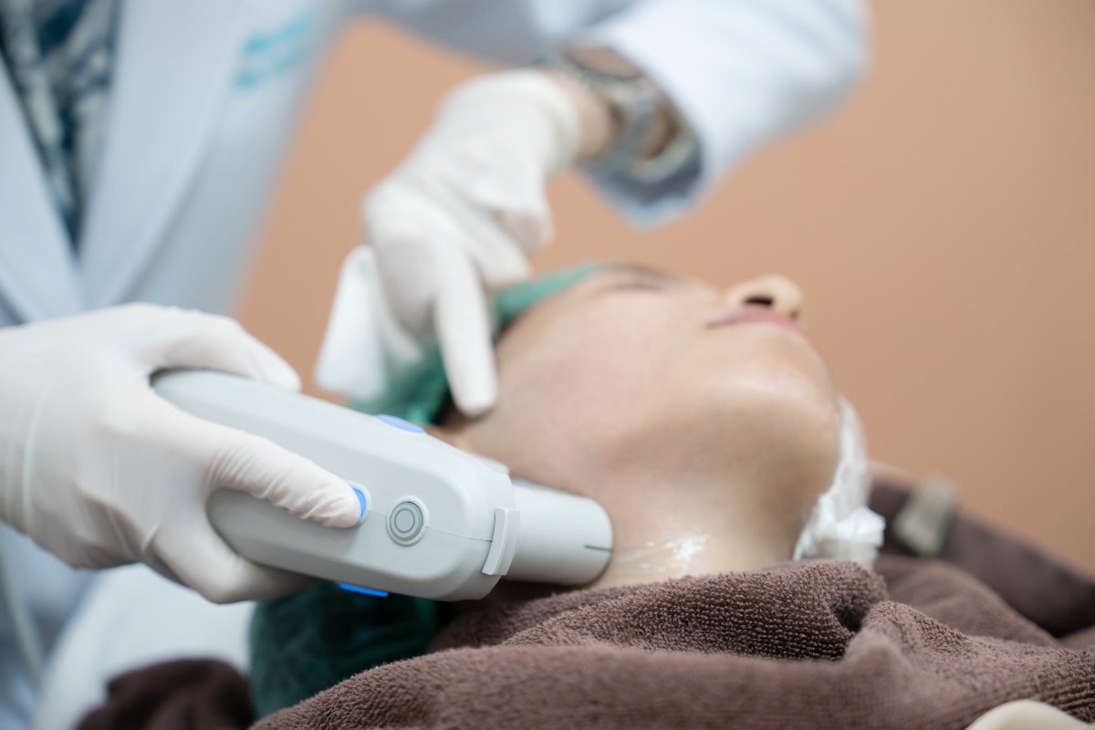HIFU Treatment