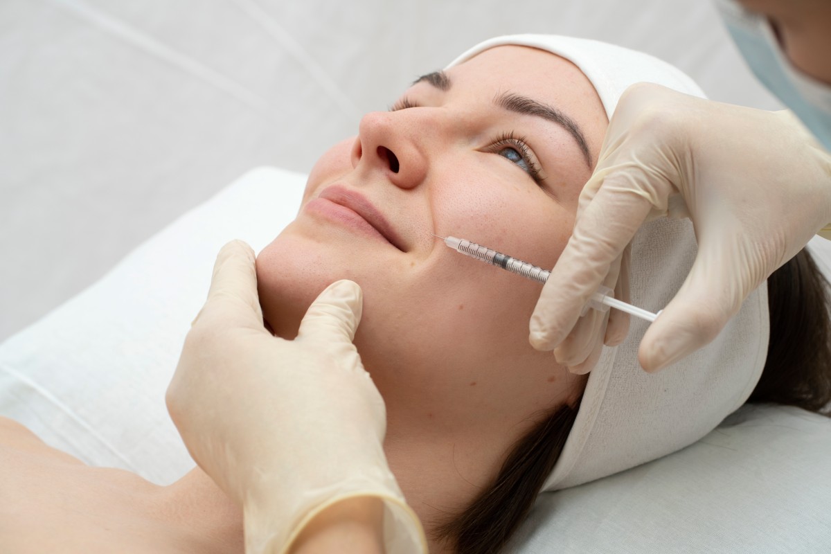 What Factors May Affect a Laugh Line Filler Plan? What Factors May Affect a Laugh Line Filler Plan?