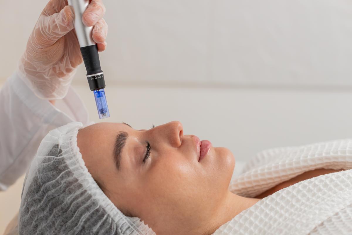 Microneedling Treatment Microneedling Treatment