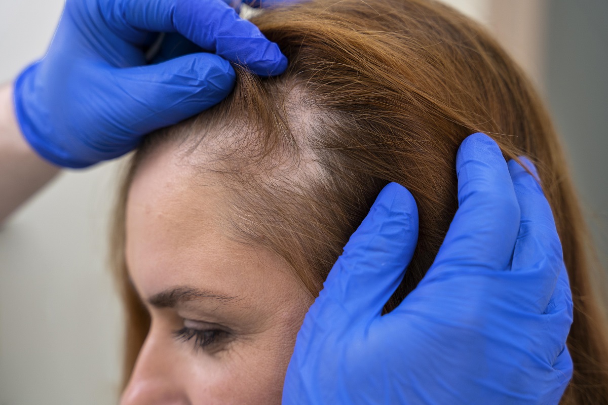 Hair Regrowth
