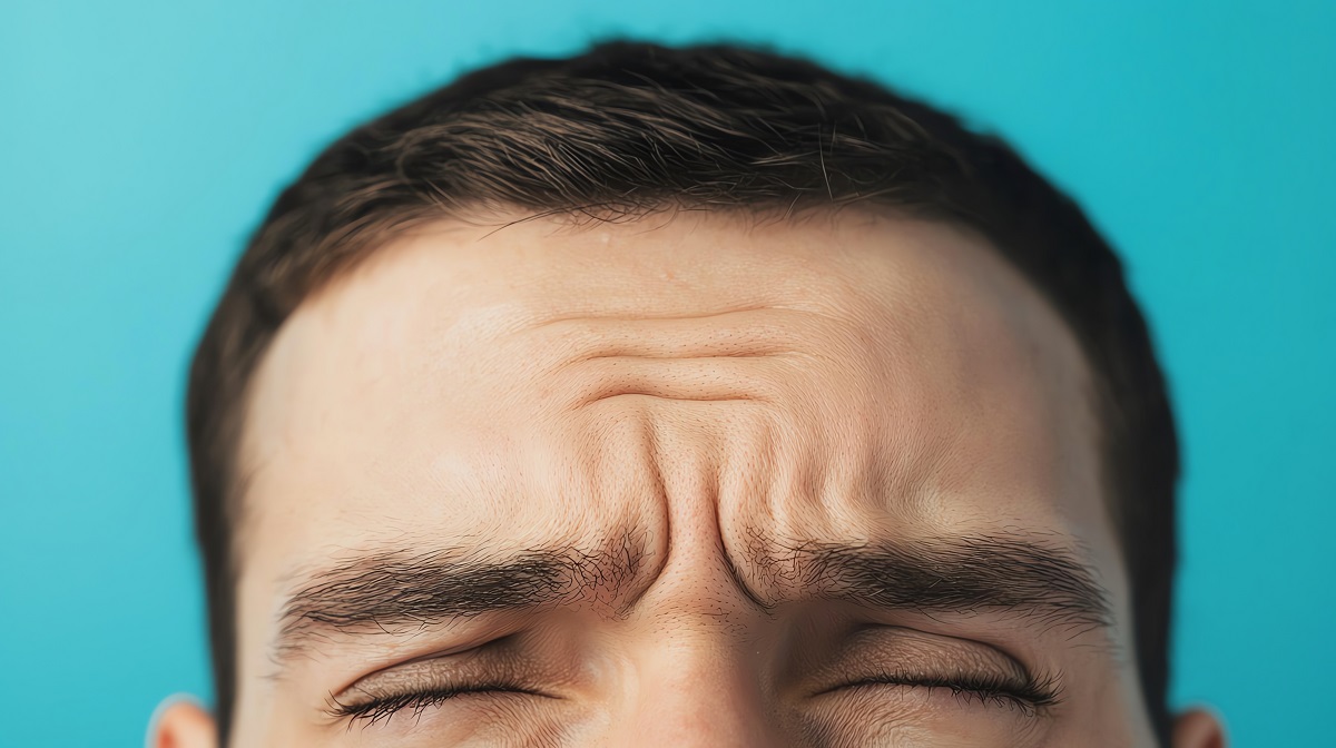 Forehead Lines Correction