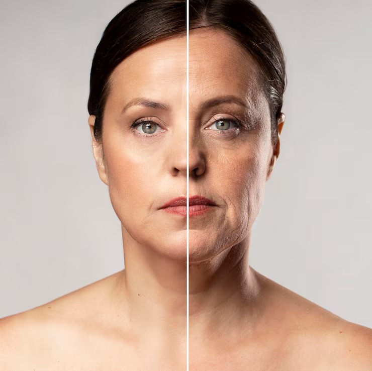prp face treatment before and after